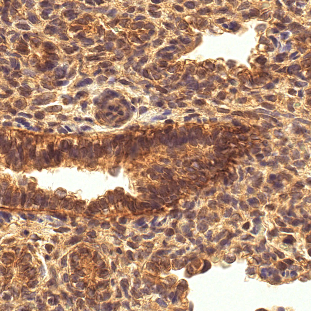 sars-cov-2 gene expression in a human fetus
